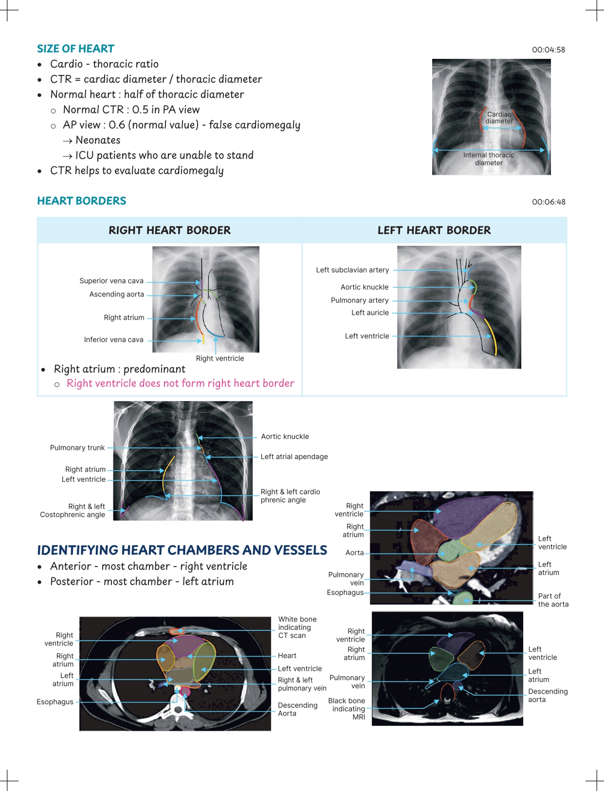 Bulletized & Concise