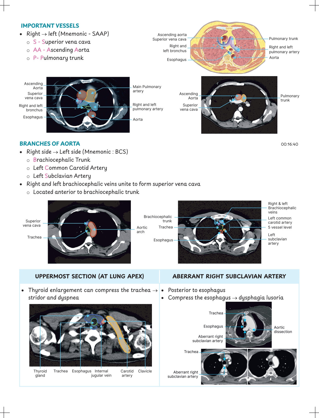 Mindmaps & Flowcharts