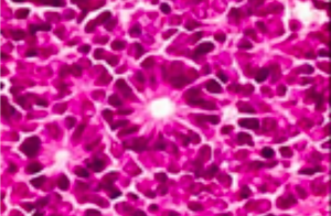 High-Yield Topics for Ophthalmology