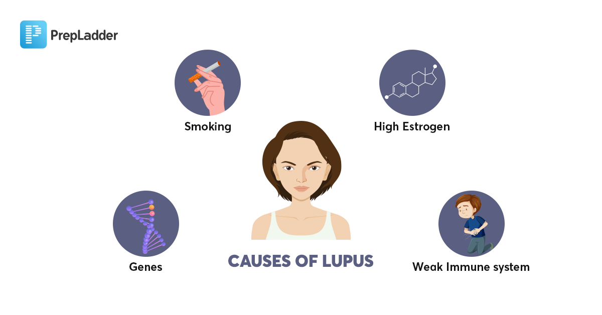 Causes of Lupus