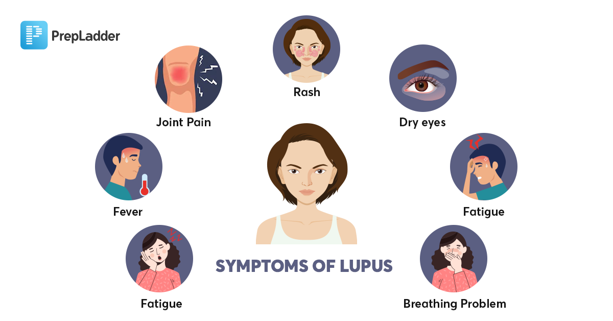 symptoms of Lupus