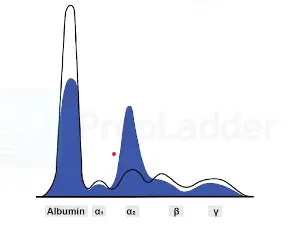 nephrotic syndrome graph