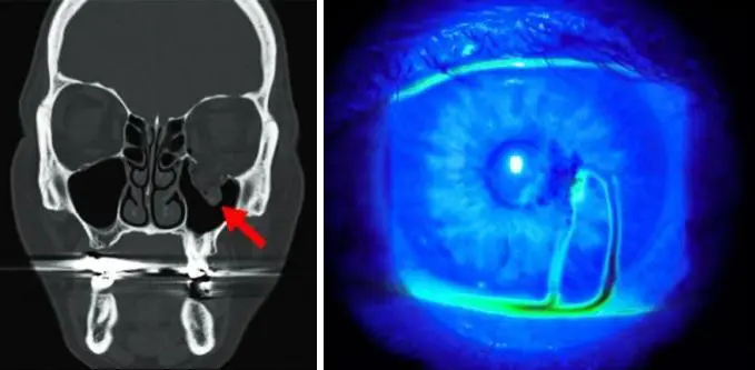 Mechanical Trauma 