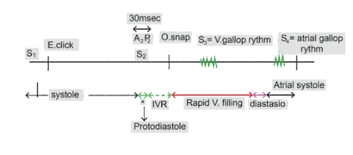 Heart sounds