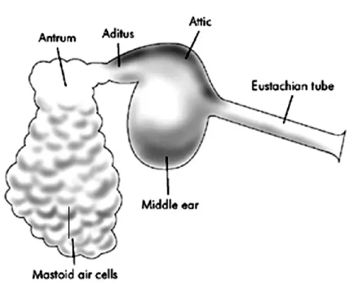 MIDDLE EAR CLEFT
