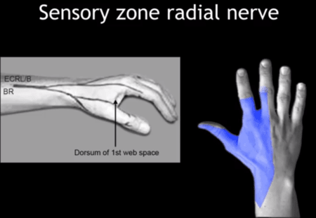 Upper Limb, Nerve Injury - NEET PG Orthopedics