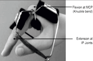 Knuckle bender splint used for Ulnar nerve  Median nerve