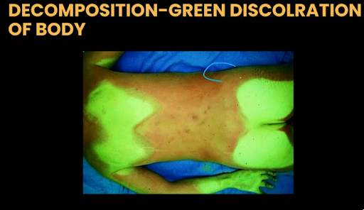  decomposition green discoloration of body