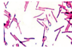 Clostridium tetani