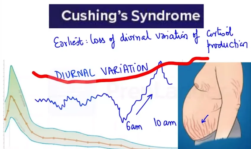 Cushing Syndrome: Causes, Symptoms & Treatment