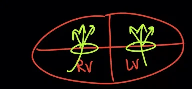 Functional mitral regurgitation