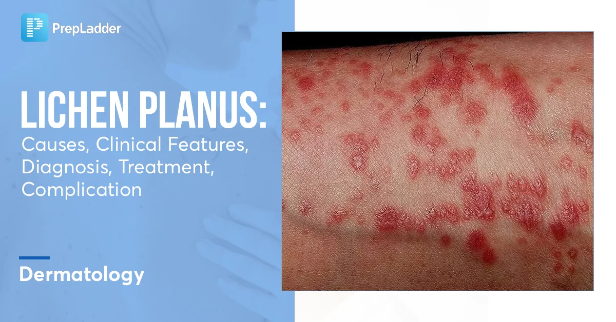 Lichen Planus Purple Skin Lesions Causes Signs 46 OFF
