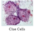 clue cells