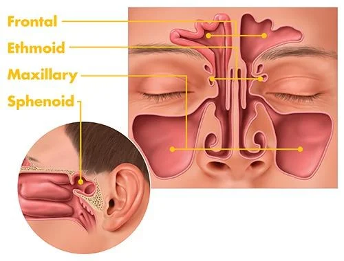 Clinical features of Acute sinusitis