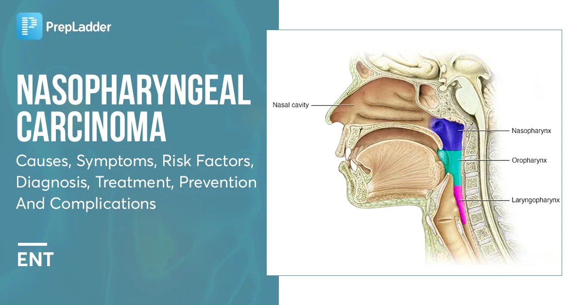 Nasopharyngeal Carcinoma Causes Symptoms And Treatment
