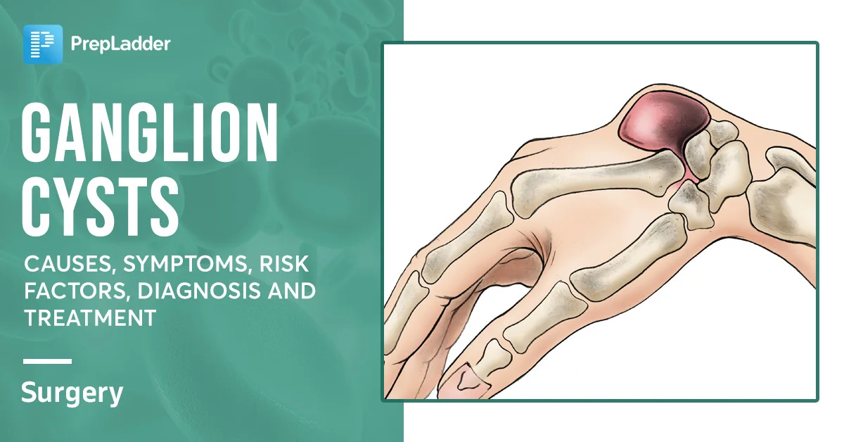 Ganglion Cysts Causes Symptoms Risk Factors Diagnosis