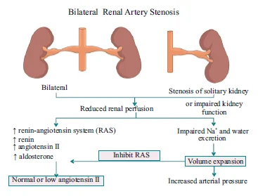 ONE KIDNEY, ONE CLIP MODEL (VOLUME HYPERTENSIVE MODEL)