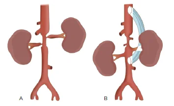  SURGICAL TREATMENT INDICATIONS