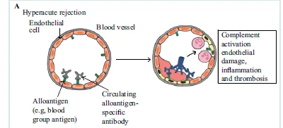 HYPERACUTE REJECTION