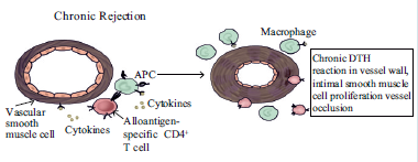 CHRONIC REJECTION