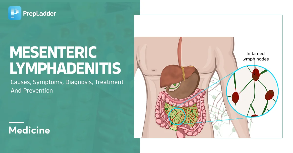Mesenteric Lymphadenitis Vrogue co