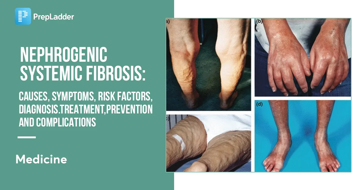 Nephrogenic Systemic Fibrosis Symptoms UNZI