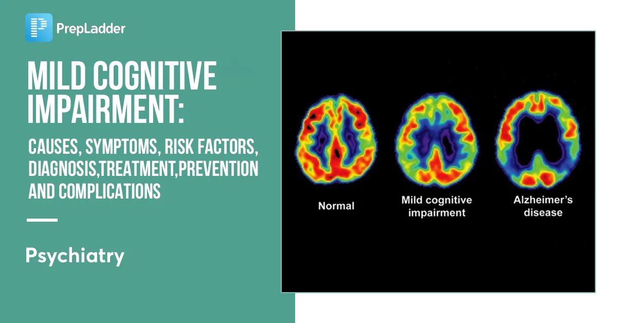 Cognitive Impairment Cognitive Dysfunction In Older Adults With Type 2