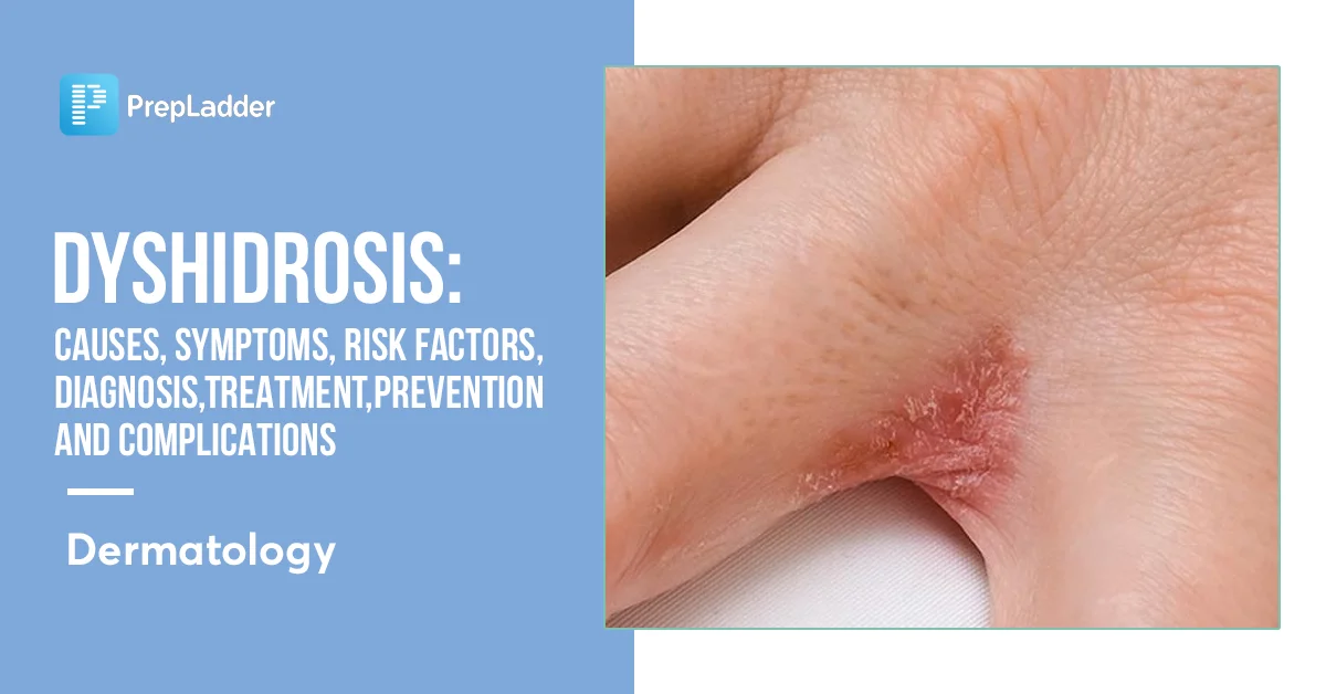 Mild Dyshidrosis Hands Treatment