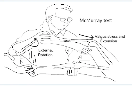 Sports Injuries Causes Treatment Prevention More
