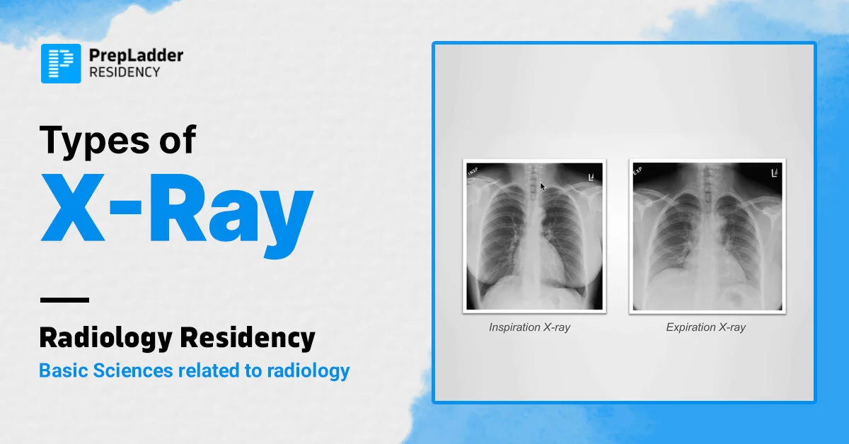 Difference Between Radiography And X Ray Difference Between Radiography And X Ray