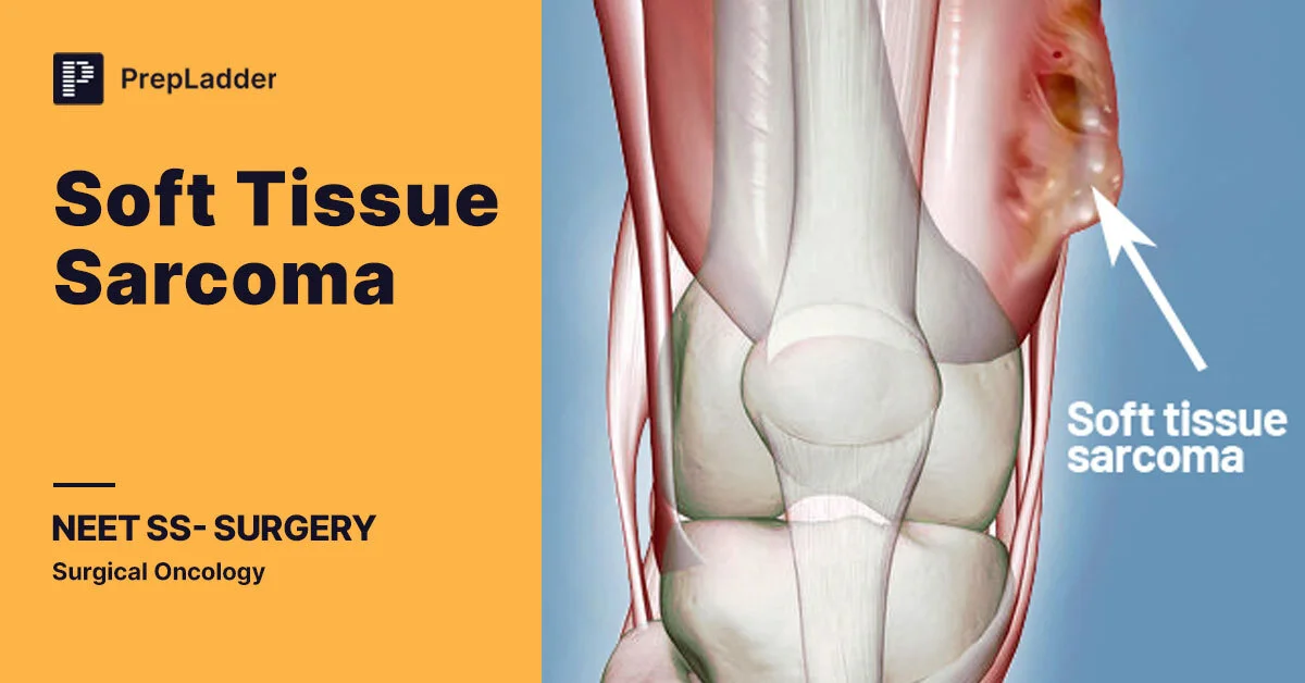 Abdominal Sarcoma Inferring Malignancy Grade Of Soft Tissue Sarcomas