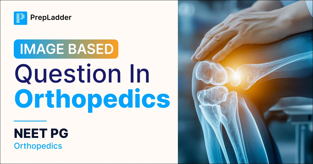 Orthopedics NEET PG Image-Based Preparation