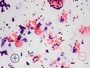 Differential Stains