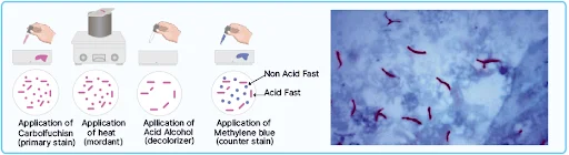 Acid-Fast Stain (Ziehl Neelsen Stain)