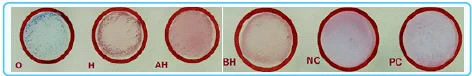 Slide widal test
