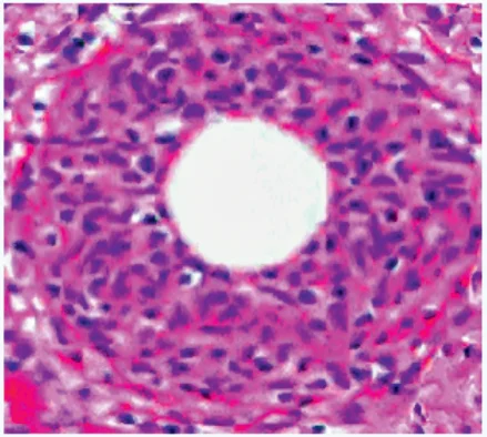 Coxiella