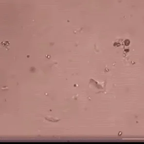 Giardia lamblia
