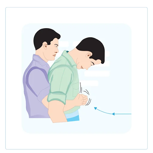 Heimlich’s maneuver
