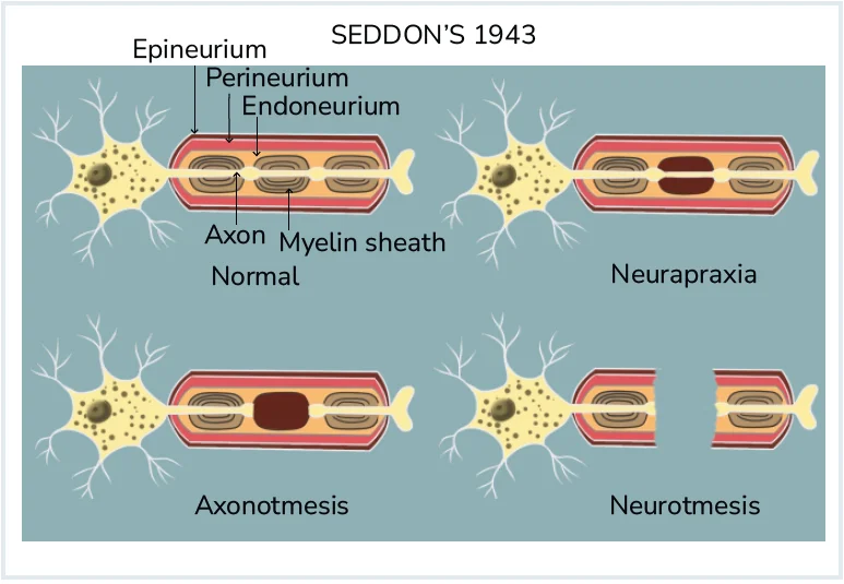 Neuropathophysiology of the Facial Nerve