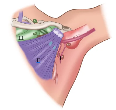 Axillary Lymph Nodes Levels