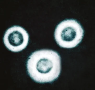 Negative stains (b/w)