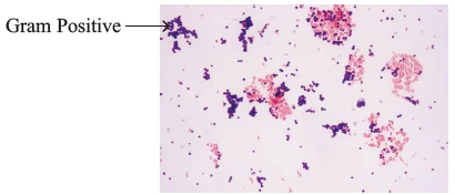 Differential Stains