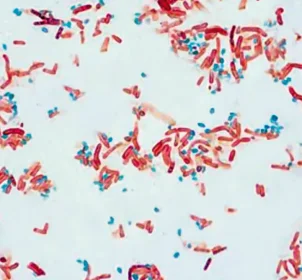 Spore Stain