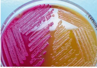 MacConkey Agar