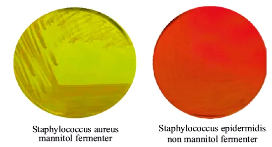 Mannitol Salt agar