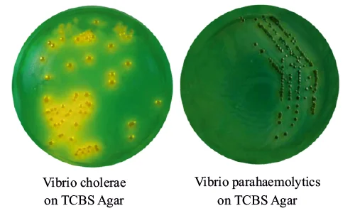 Thiosulfate Citrate Bile Salt Sucrose (TCBS)
