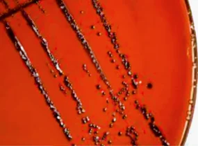 Potassium Tellurite Agar