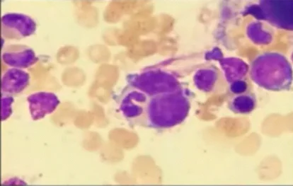 emperipolesis