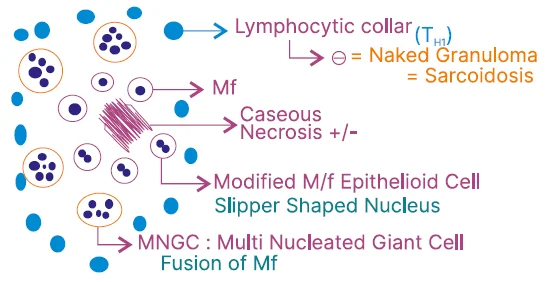 mechanisms of chronic inflammation