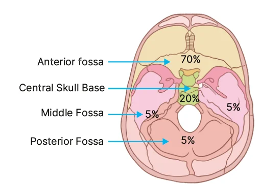 incidences of various types of skull base fractures